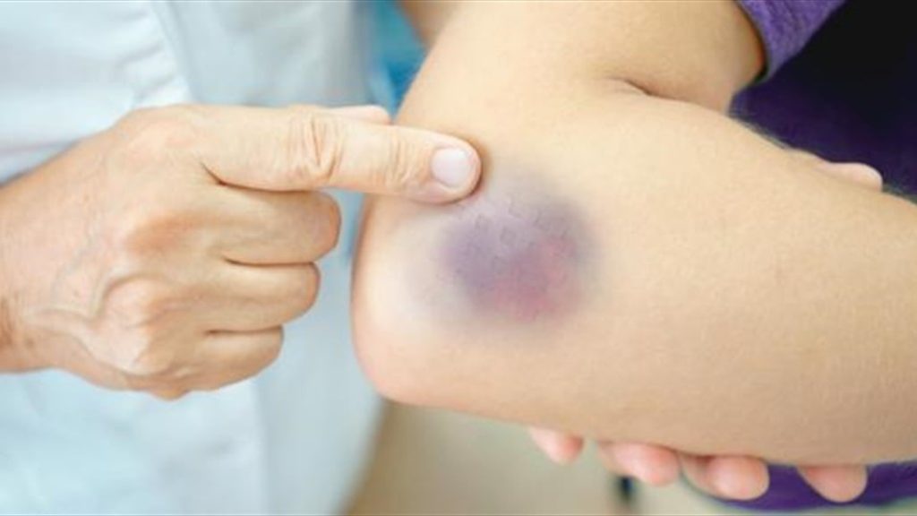 لماذا يستغرق جسمك وقتا أطول للتعافي بعد سن الـ40؟