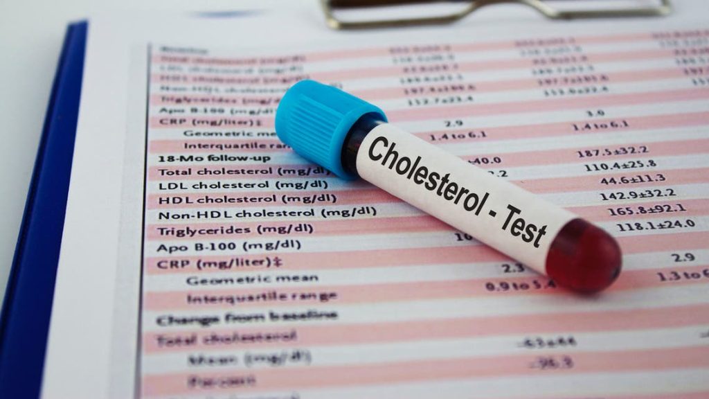 علامات مبكرة لارتفاع نسبة الكوليسترول فى الدم