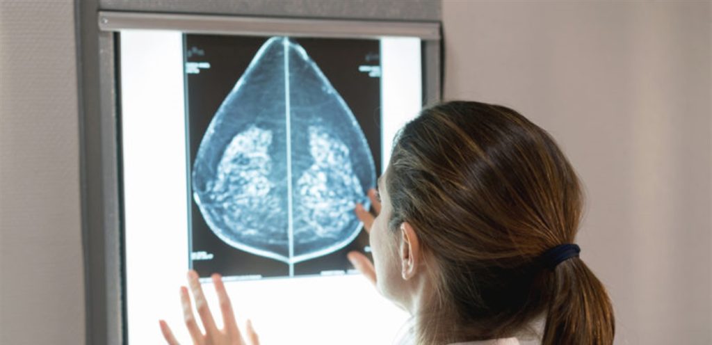 علاج ثوري للسرطان .. قد يحمل الأمل في إطالة عمر المرضى!