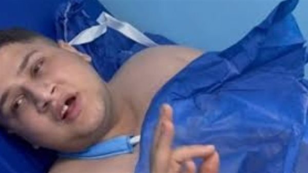 إصابة التيك توكر محمد فرج في حادث سير.. والنيابة تباشر التحقيق