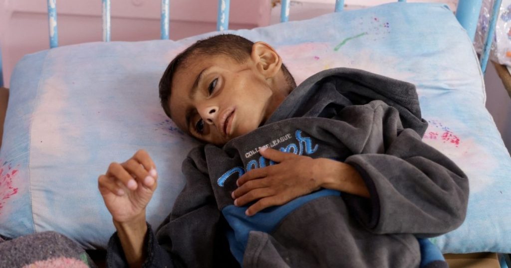 تحذير أممي من تفاقم أزمة الجوع في 13 منطقة على مستوى العالم