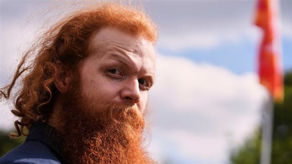 اكتشاف طبي هام حول جين الشعر الأحمر