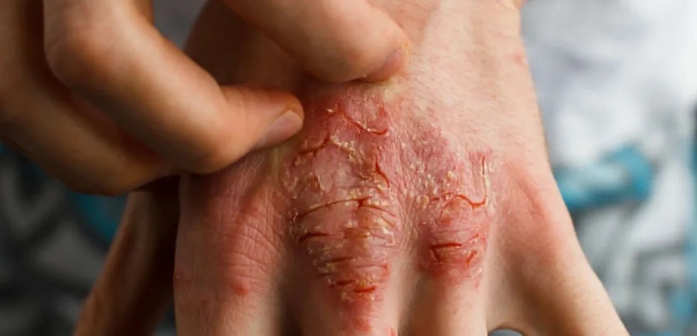 أطباء الجلدية في تركيا.. بين الطب الحديث والجراحة التجميلية