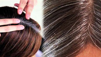 خبر سار.. أطعمة تعالج الشعر الأبيض وتعيد الشباب